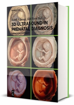 3D Ultrasound in Prenatal Diagnosis